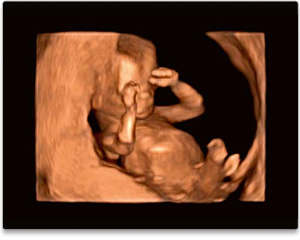 Ultraschall bei Schwangerschaft inkl. Organ-Screening in 1200 Wien